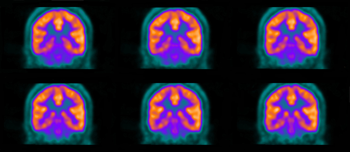 Vanderbilt University