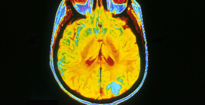 Vanderbilt University