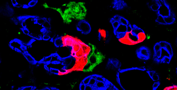 Vanderbilt University