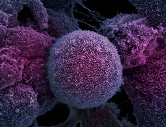 Vanderbilt University