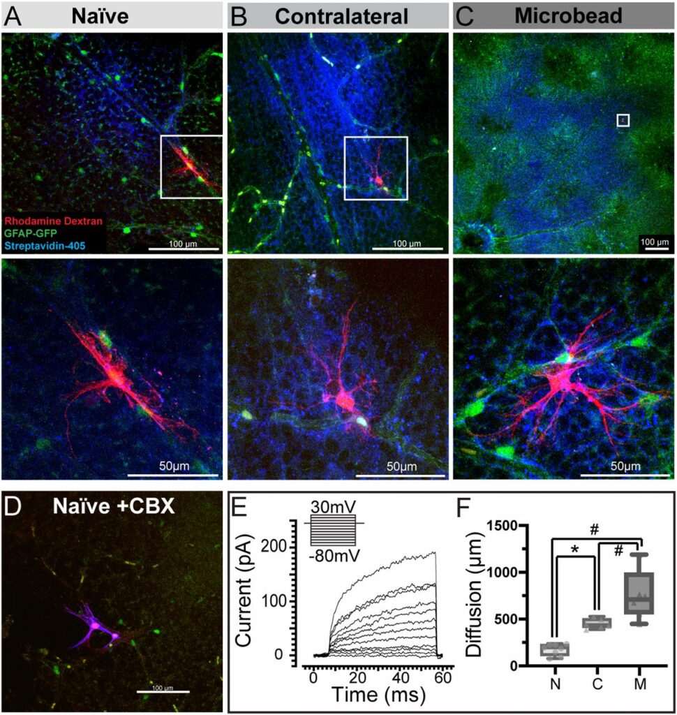 caulkins_f3-large_-970x1024
