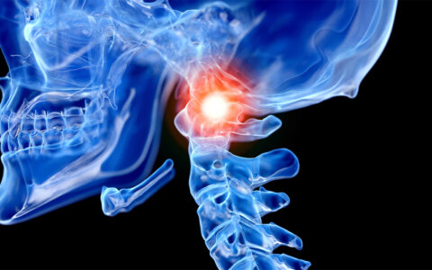 Artistic illustration of a skull and spine, with a bright red spot at the base of the skull where it attaches to the spine