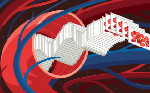 Rare disease treatment with AI