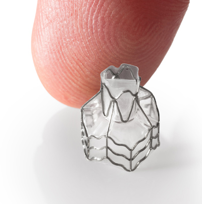 A new medical device called the Zephyr Valve offers a minimally invasive alternative to lung surgery for emphysema patients.