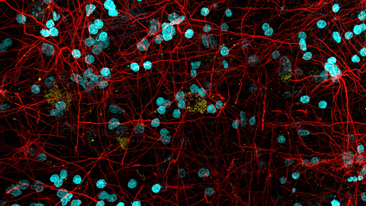 Fluorescence microscopy image showing a network of red strings and clusters of cyan oval shapes. Some sites of yellow are faintly visible.