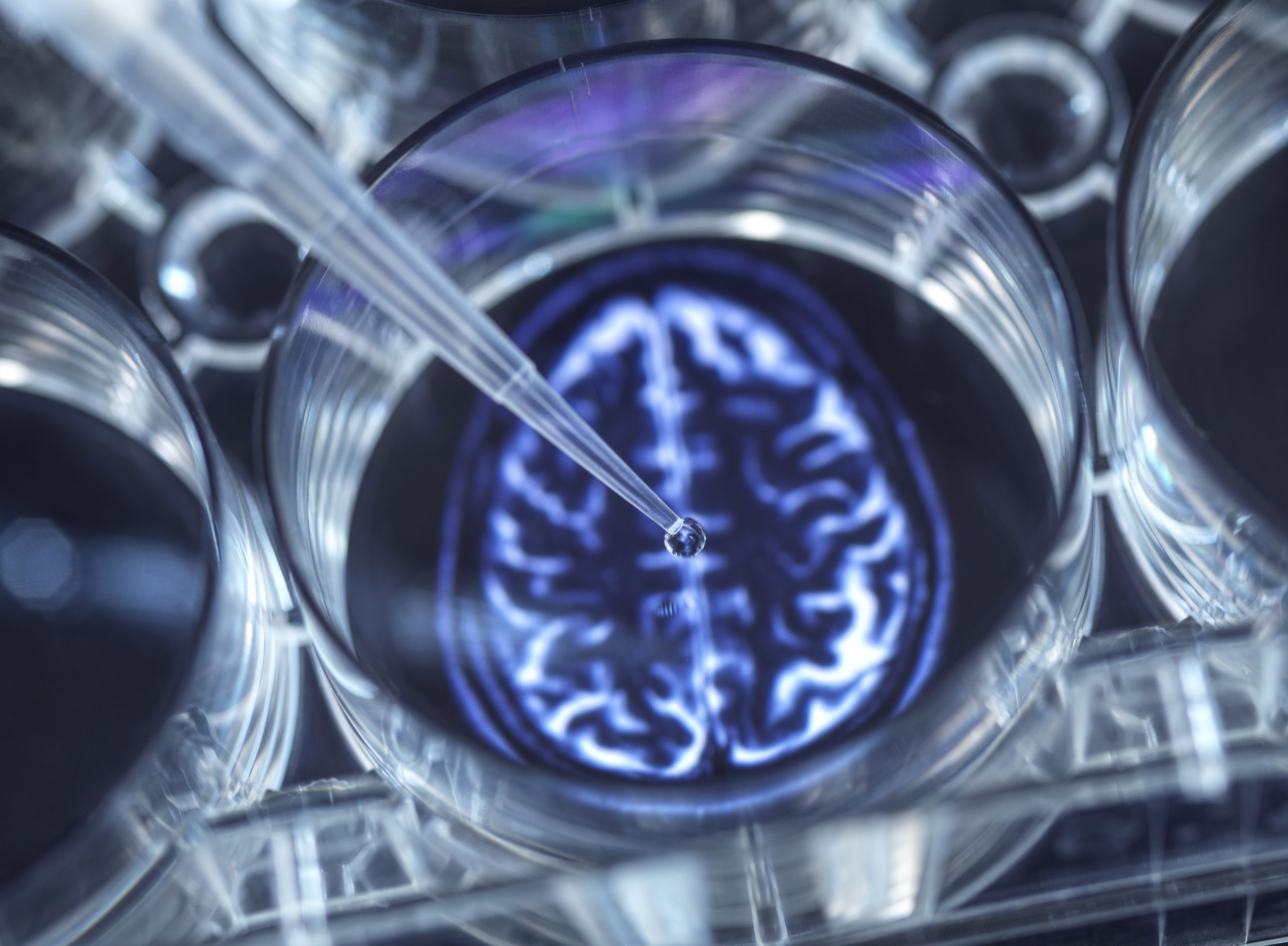 Jackson Lab reveals relationship between transport proteins and brain disease