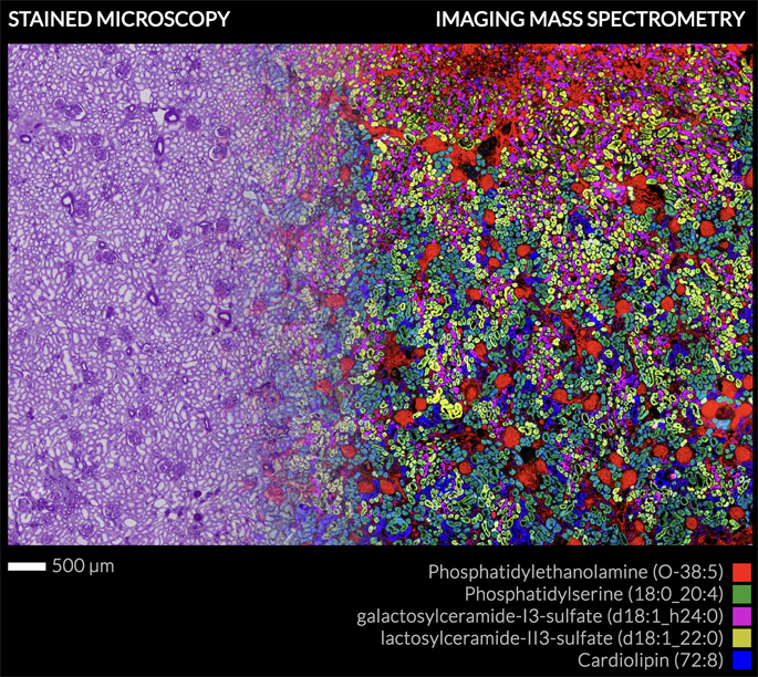 Spraggins, Caprioli win $13.6M from NIH to create “atlases” of the brain, kidney and eye