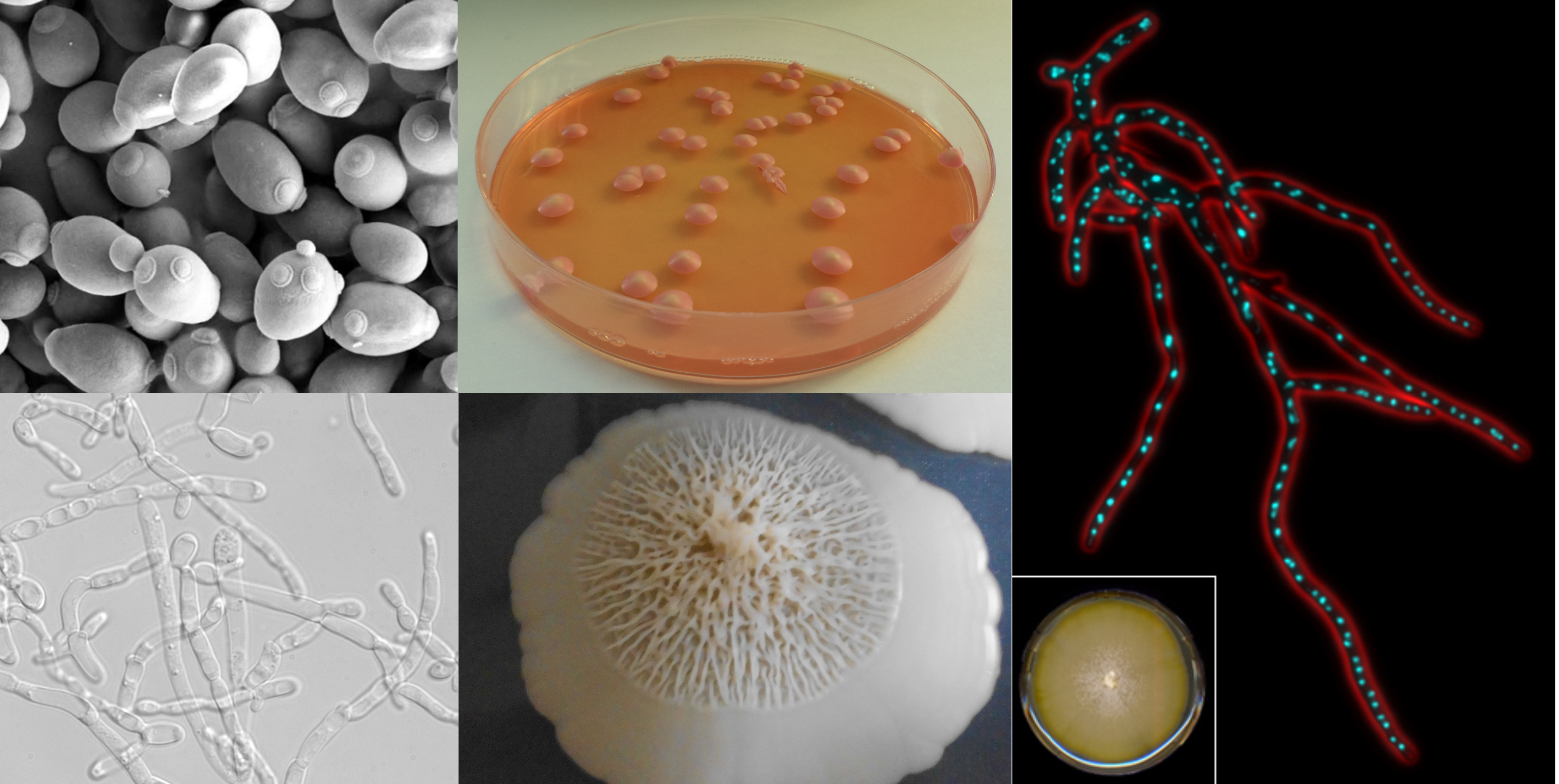 A group of 5 different yeasts showcasing their diversity, some long a spindley, some fat little blobs, some mushroom-like