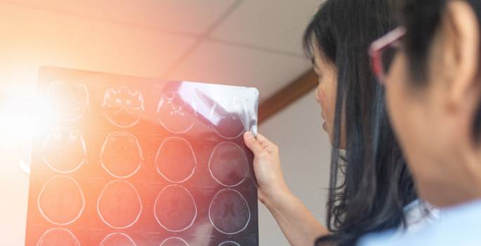 Imaging “biomarker” for Alzheimer’s disease progression