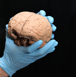 Vanderbilt University