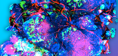 Vanderbilt University