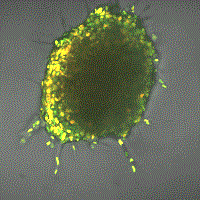 Vanderbilt University