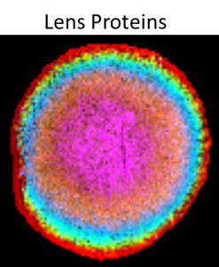 Lens.proteins