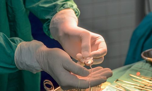 Vanderbilt University