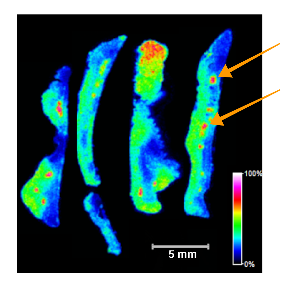 Vanderbilt University