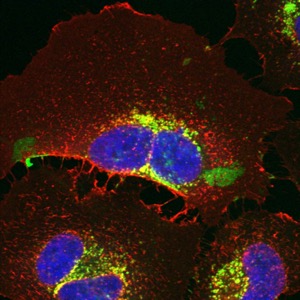 Living human HeLa cells with the addition of fluorescently tagged purified E protein
