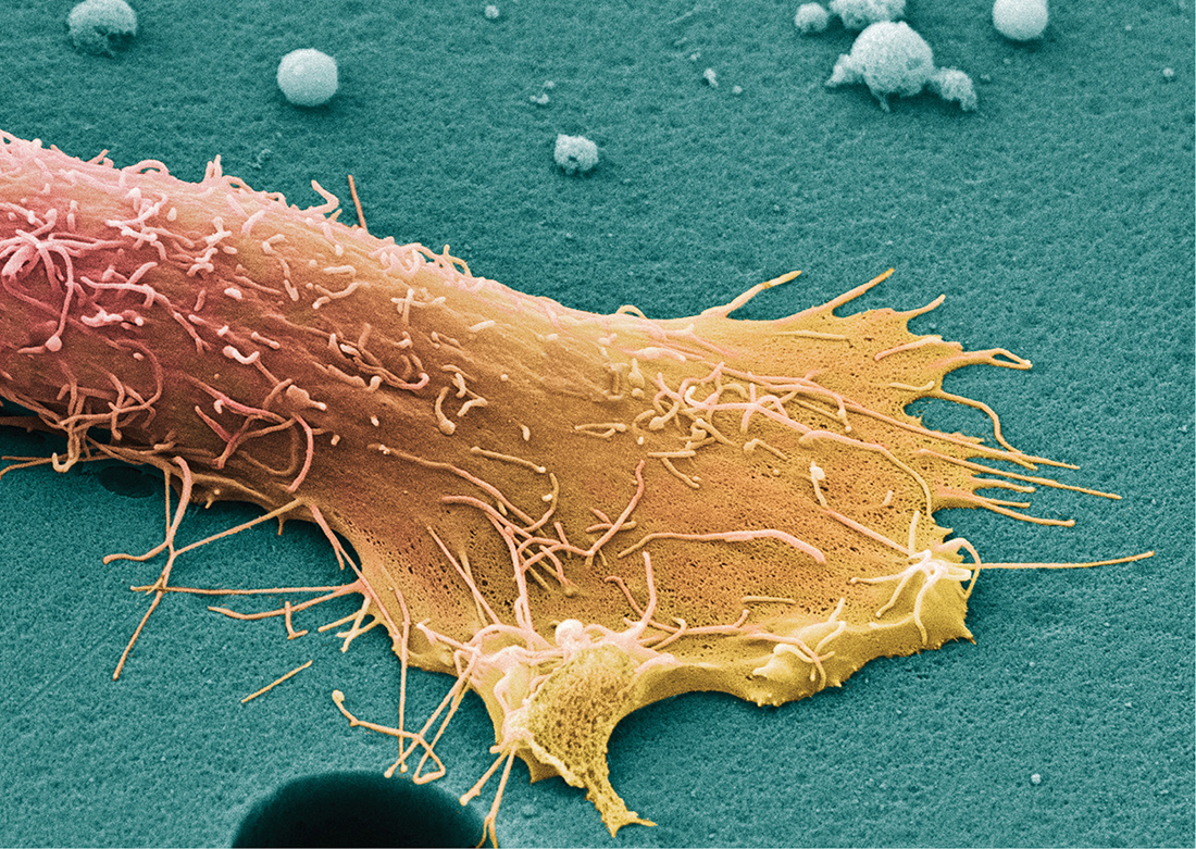 Vanderbilt University