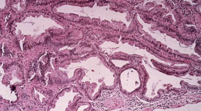 Vanderbilt University