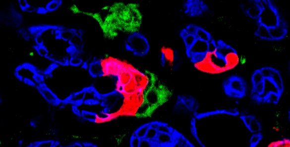 Vanderbilt University