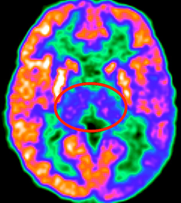 Vanderbilt University