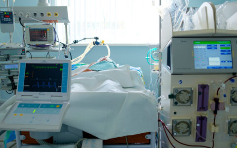 Emergency patient in critical state with intraaortic balloon pump and extracorporeal circuit hemodialysis assist
