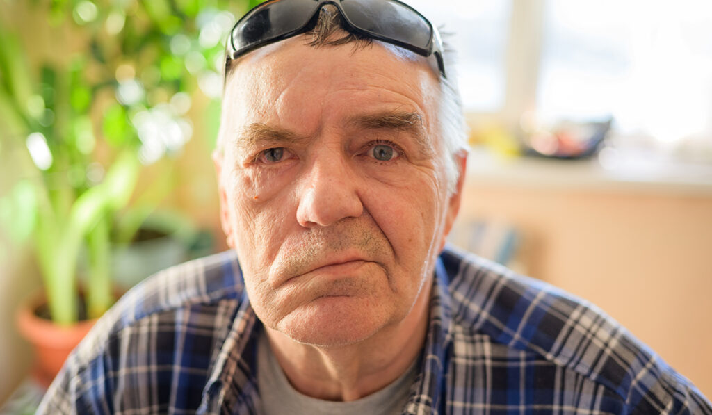 Person with facial droop