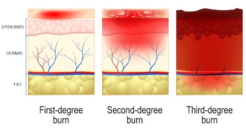 Vanderbilt University
