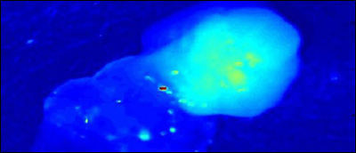 Vanderbilt University