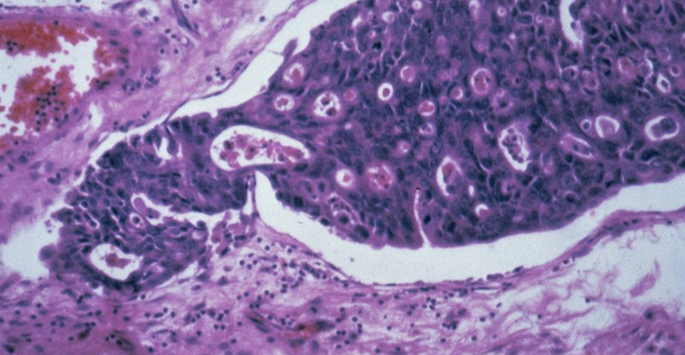 Vanderbilt University