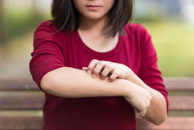 Woman experiencing contact dermatitis symptoms, scratching forearm