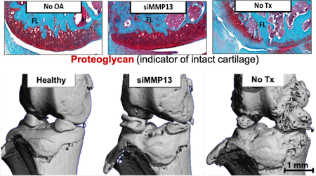 Vanderbilt University
