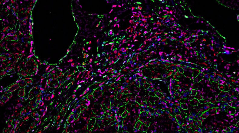 Vanderbilt University