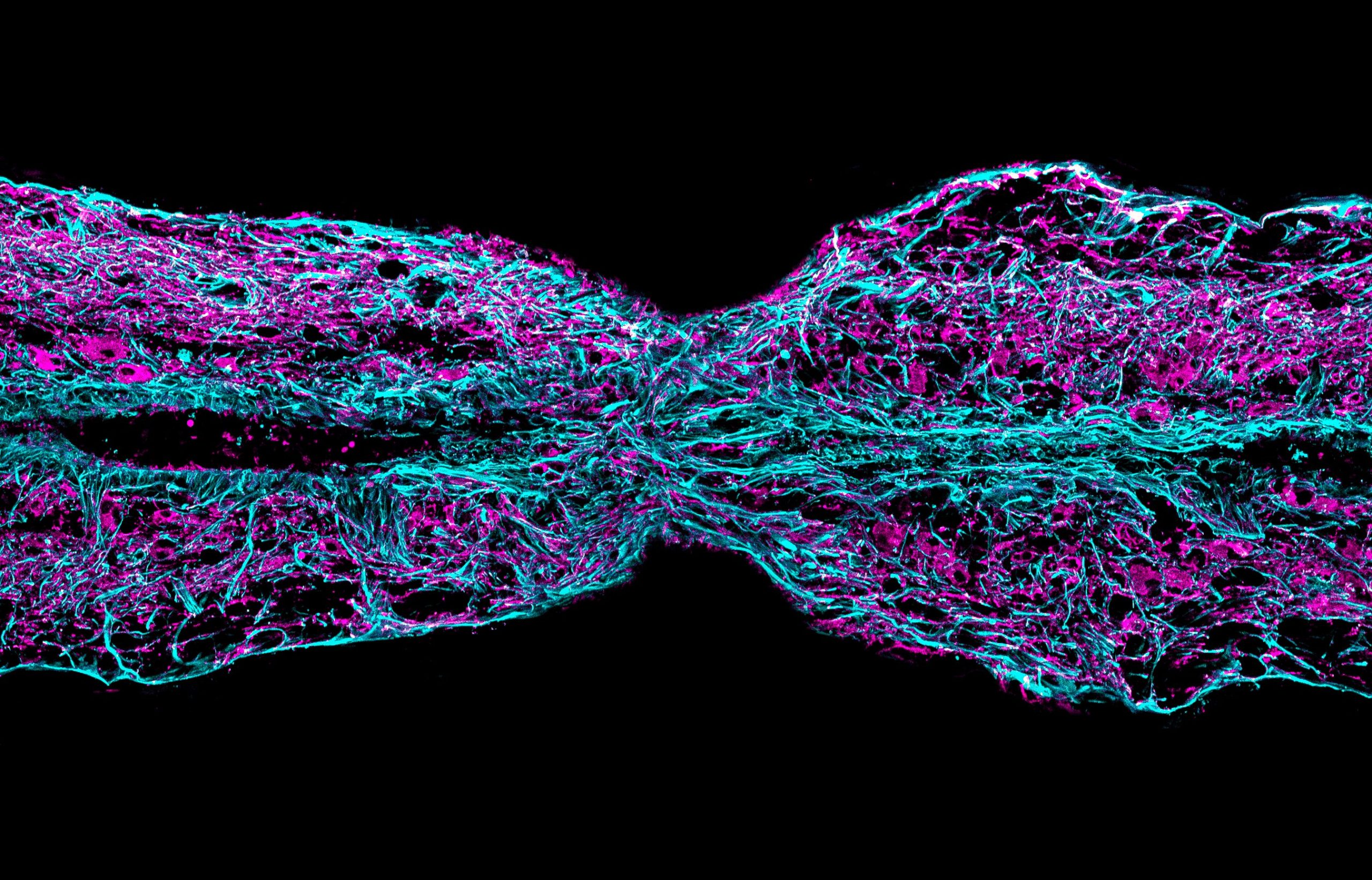 immunofluorescence microscopy image of a severed zebrafish spinal cord that is in the process of regenerating. This looks like two purple and cyan stumps being 