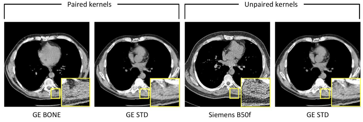 Vanderbilt University