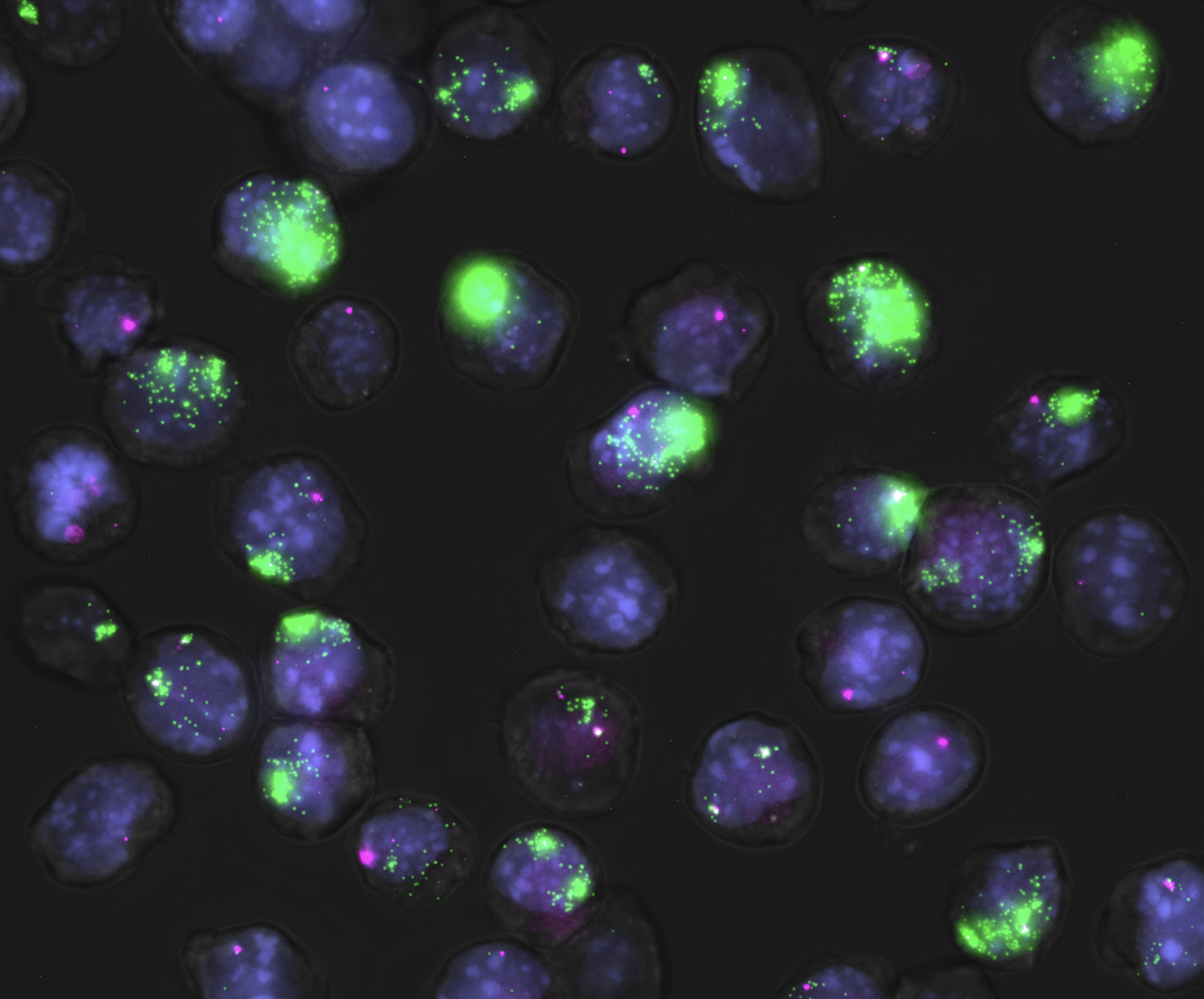 Fluorescence image clearly showing individual cells that are purple/blue in color. Many of the cells have green punctae, but in varying quantities, indicating that the situation in each cell is independent of the other cells. A small number of cells has magenta puncta.