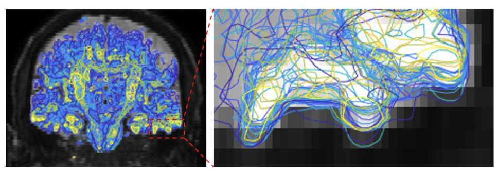 Vanderbilt University