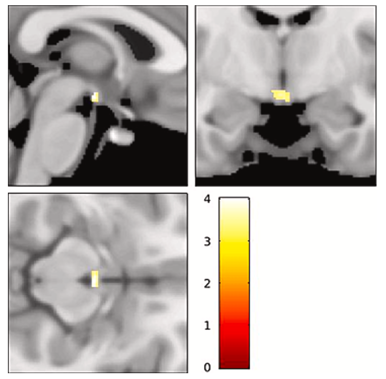 Vanderbilt University