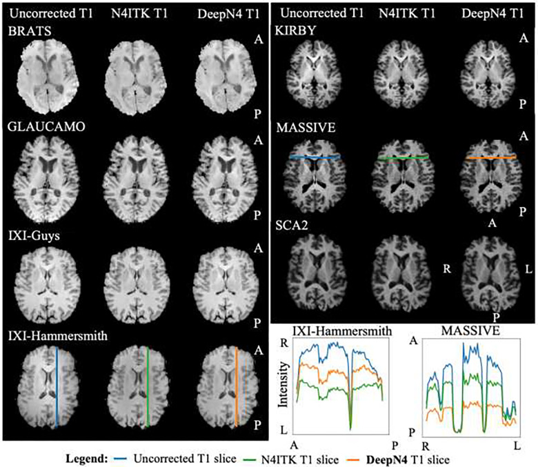 Vanderbilt University