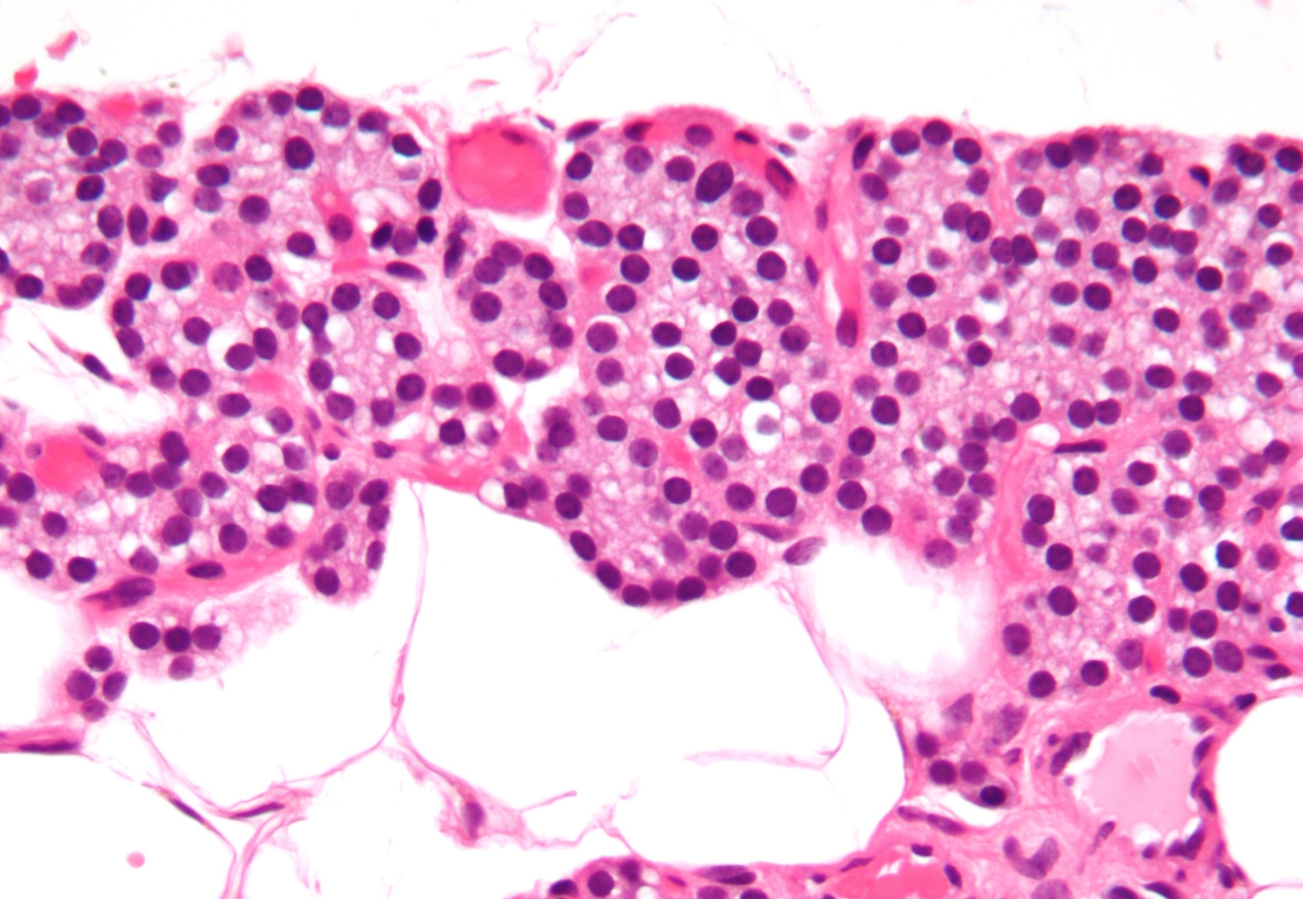 Vanderbilt University