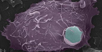 Vanderbilt University