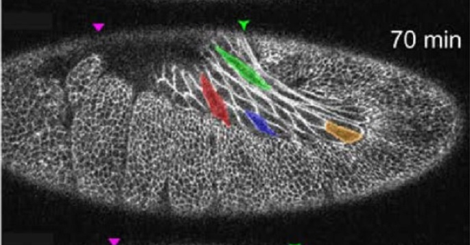 Vanderbilt University