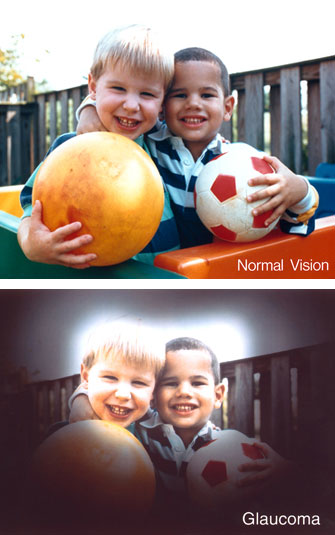 (National Eye Institute)