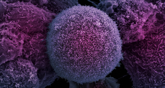 Vanderbilt University