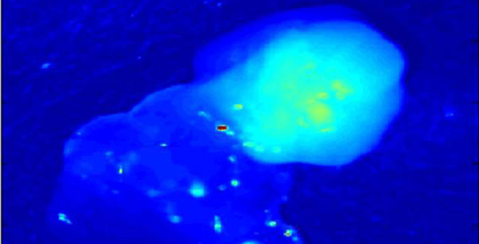 Fluorescing parathyroid