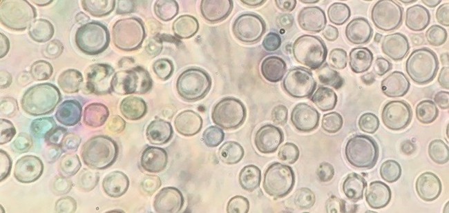 microphotograph of bubble-like cells