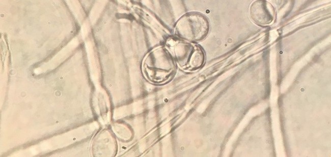 microphotograph of sperm-like cells