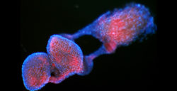 red blob surrounded by blue outline