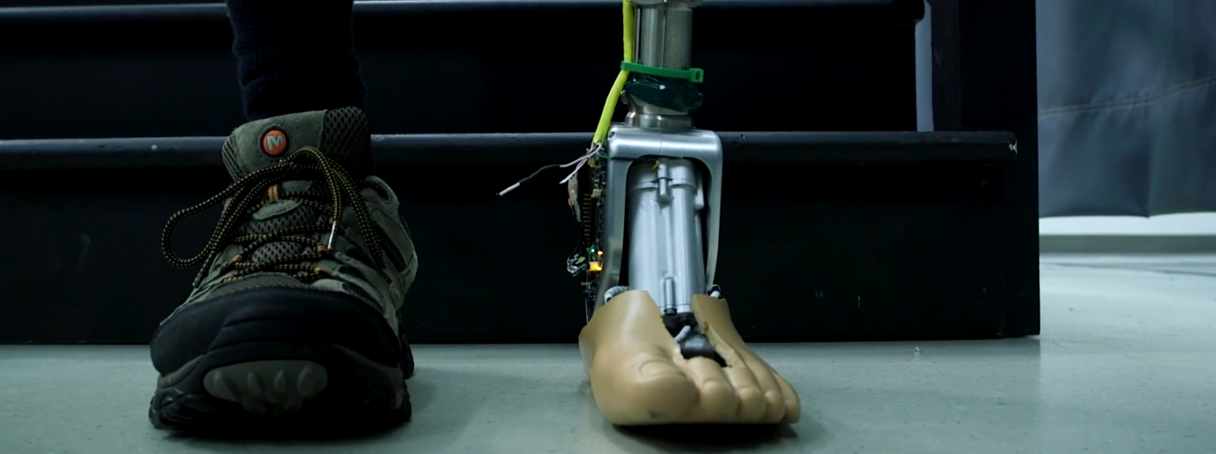 Prosthetic ankle