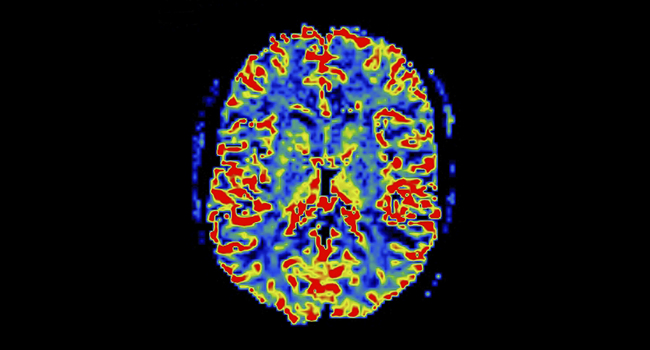 Vanderbilt University