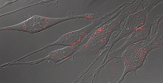 Neurons_serotonin_main Neurons with serotonin transporters labeled with quantum dots. (Jerry Chang / Vanderbilt)